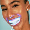 Donna con boccaglio in bocca del set di sbiancamento dentale PAP+ di Diamond Smile