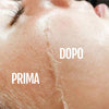 Dispositivo dermaplaning Diamond con lame Microfine Edges per precisione
