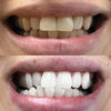 Strisce PAP+ Sbiancanti Denti sbiancamento dei denti