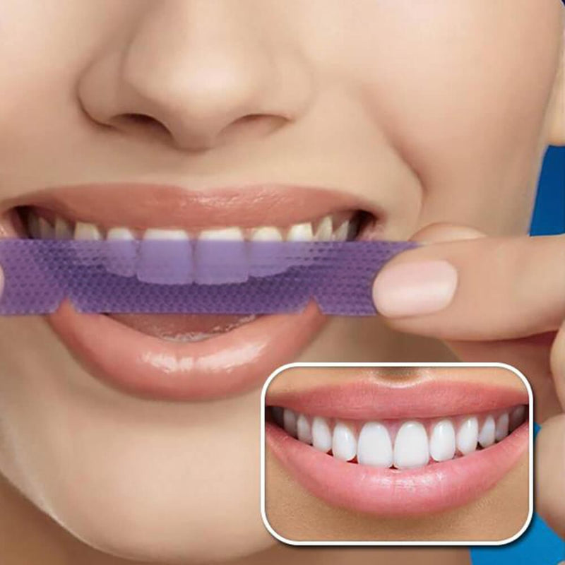 Miglior Strisce 2025 Sbiancanti Denti - Teeth Whitening Strips - Diamond  Smile Italia