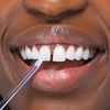 Donna con denti bianchi e stick sbiancante di Diamond Smile sul dente