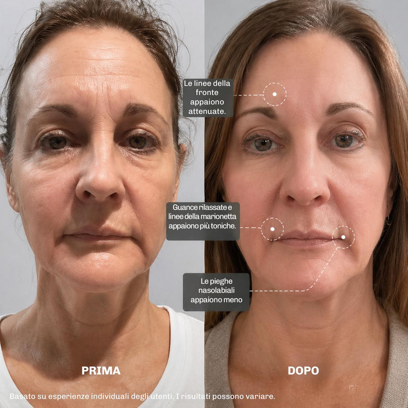 MicroLift Shot