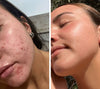 Maschera LED Anti-Età