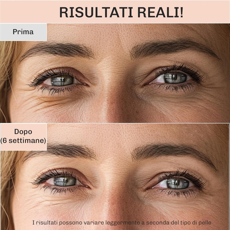 Crema occhiaie e borse Diamond per sguardo riposato