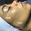 Dermaplaning Diamond migliora l’assorbimento dei prodotti skincare
