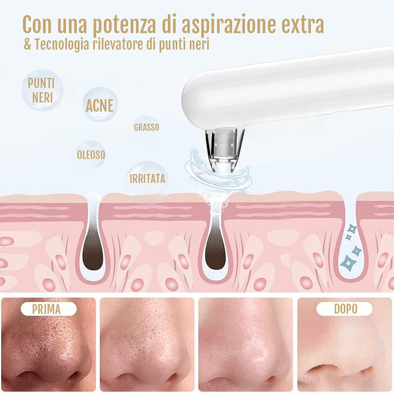 Dispositivo Diamond per rimozione impurità e cellule morte