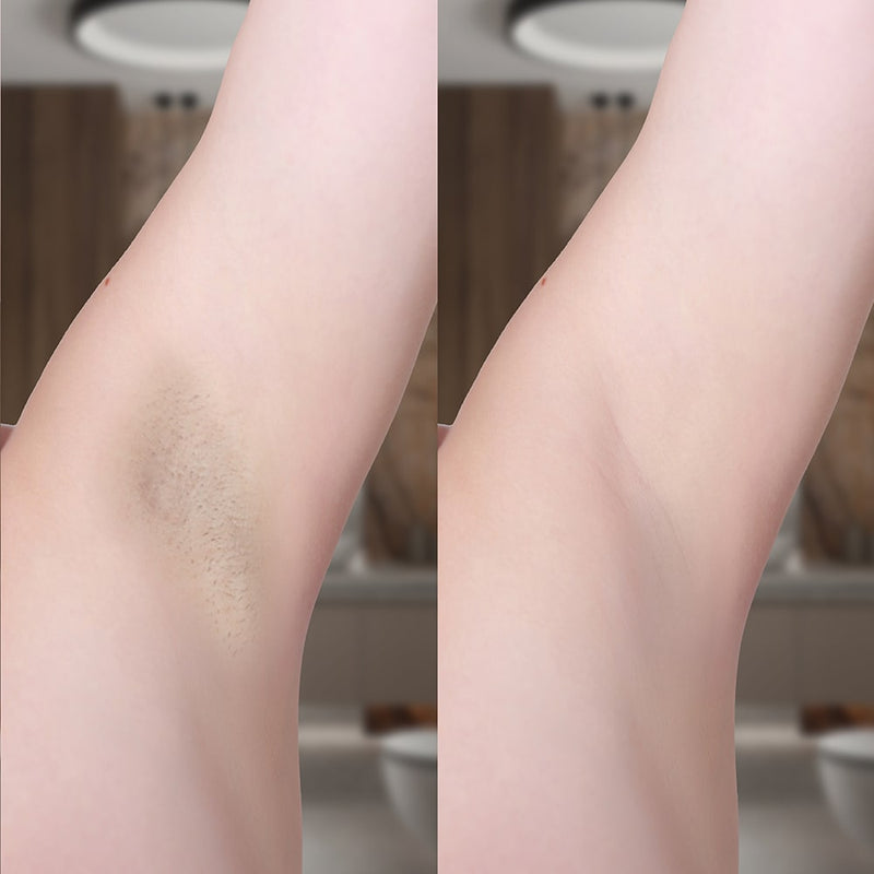 Epilatore IPL Diamond con livelli di intensità regolabile e modalità automatica