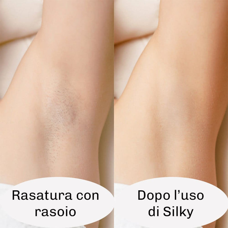 Epilatore IPL Diamond ideale per trattamento corpo completo