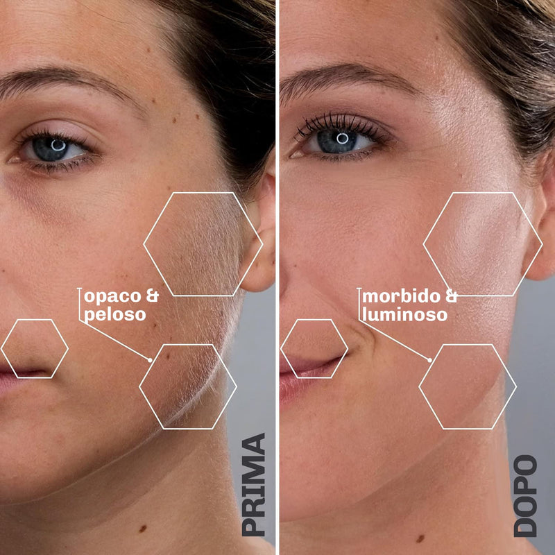 Epilatore a ultrasuoni Diamond adatto a pelle sensibile