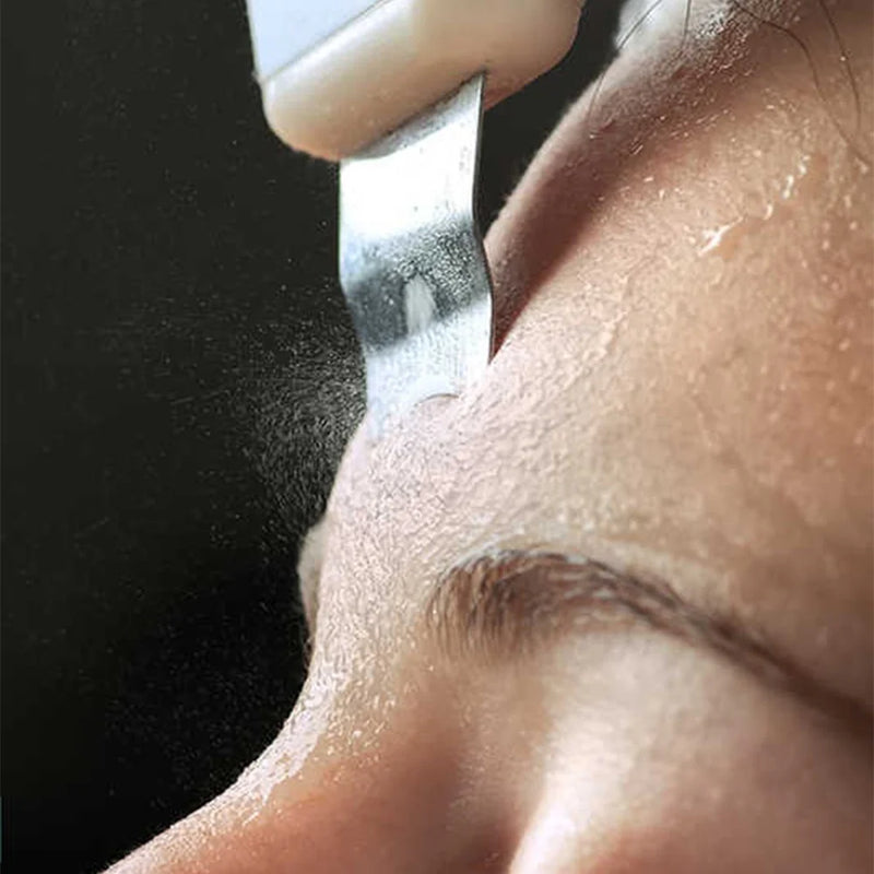 Esfoliazione ultrasuoni Diamond per liberare i pori