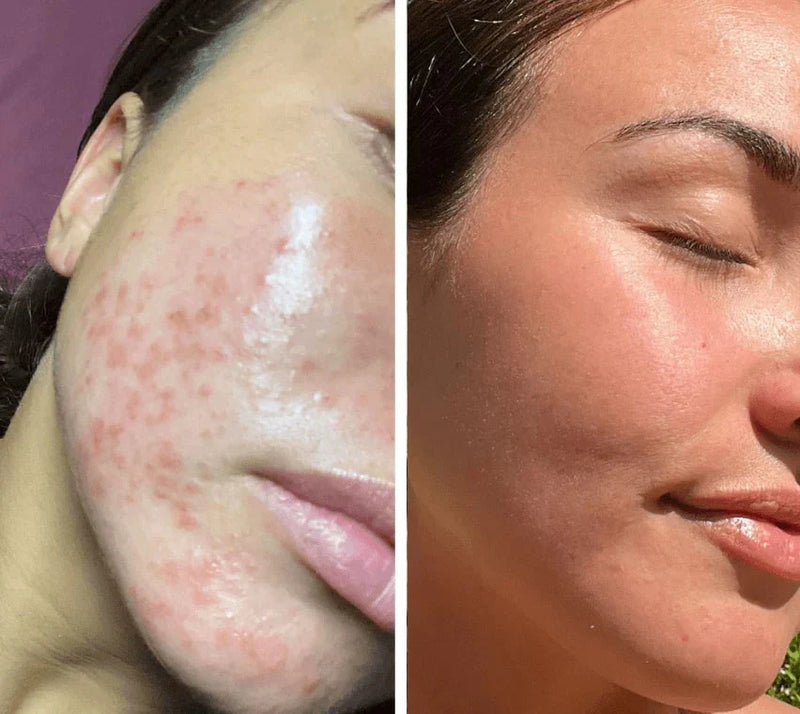 Maschera LED Diamond in silicone flessibile nero