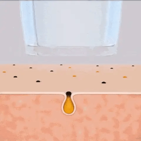 Pulizia pori elettrica viso Diamond con tecnologia avanzata