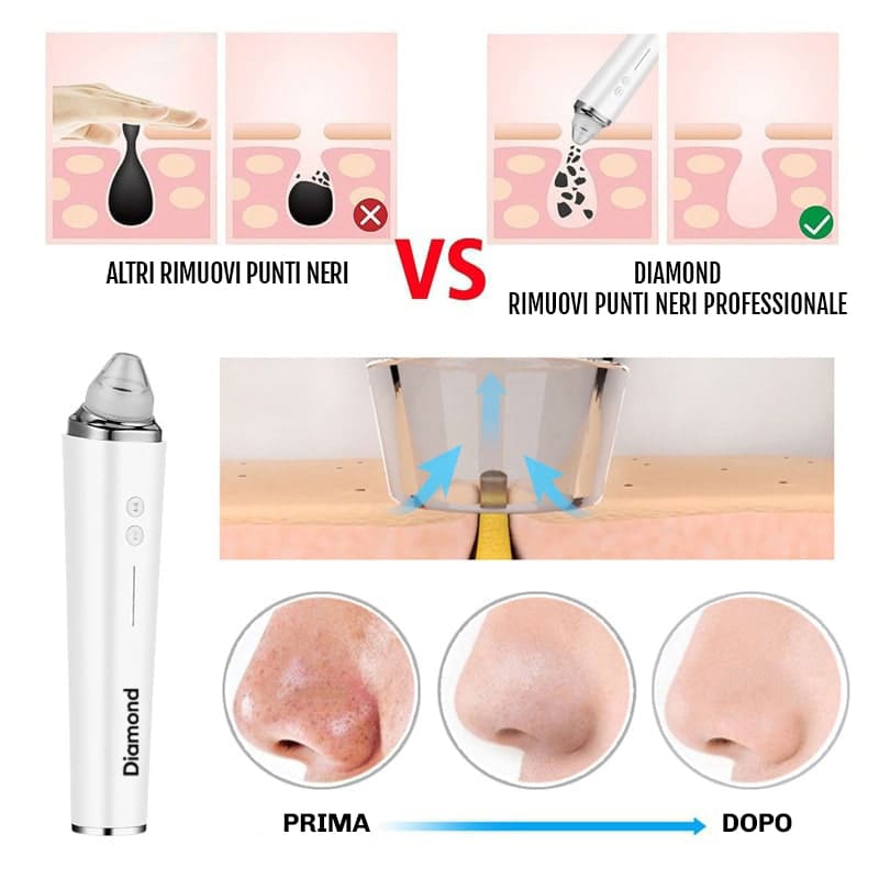 Dispositivo pulizia pori viso Diamond con aspirazione avanzata