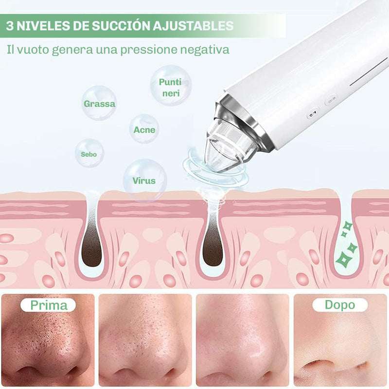 Set pulizia pori completo Diamond per routine skincare a casa