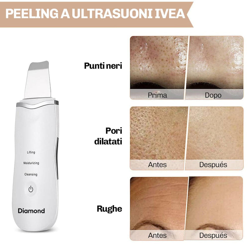 Spatola viso Diamond per stimolare la rigenerazione cutanea