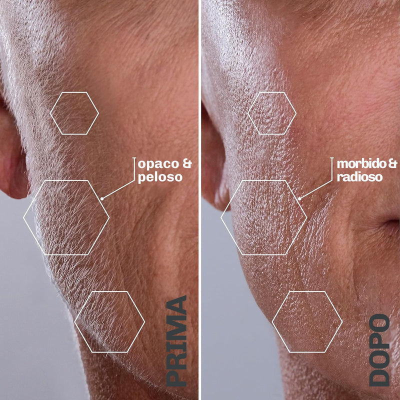 Strumento dermaplaning ricaricabile Diamond con lame intercambiabili
