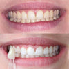 Denti bianchi grazie al dentifricio sbiancante